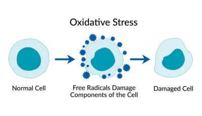 Oxidative Stress